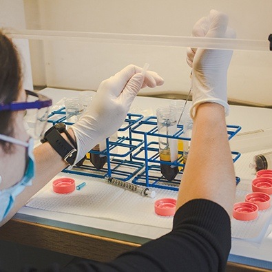 Doctor extracting plasma from test tube before PRP therapy