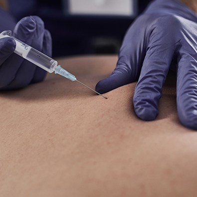 Patient receiving orthobiologic injection