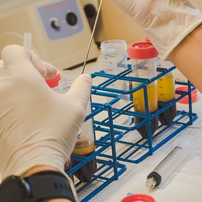 Doctor taking plasma from test tube